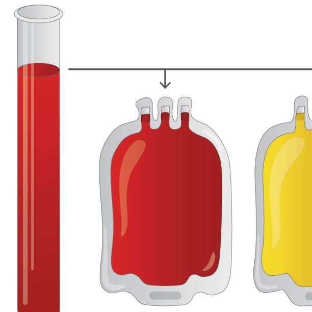 Hjemmetransfusion af patienter med kronisk transfusionskrævende anæmi ...